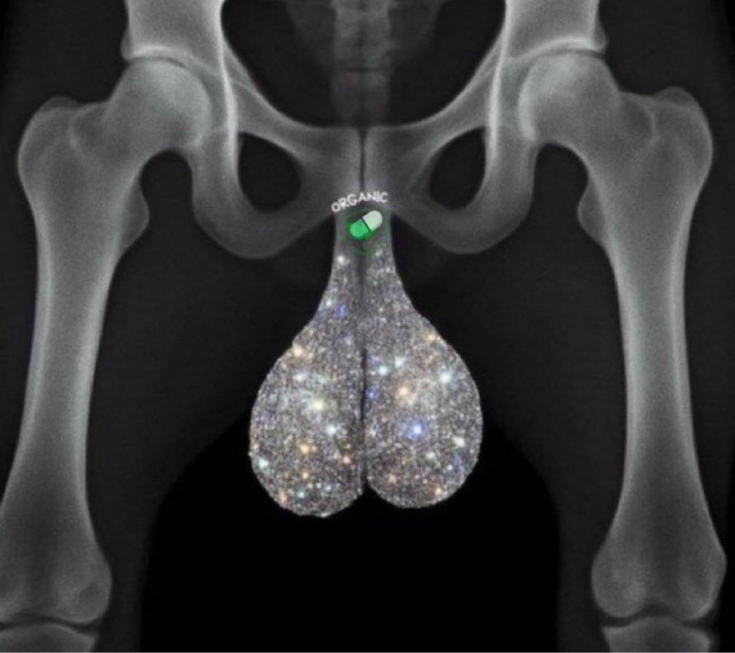 Absurd x-ray meme with a green pill labeled organic